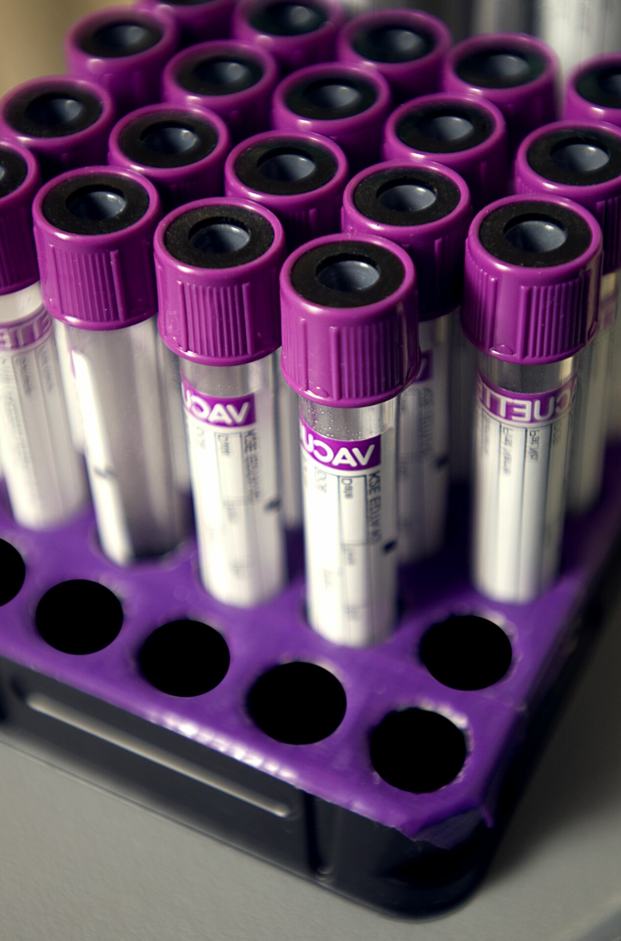 lab test